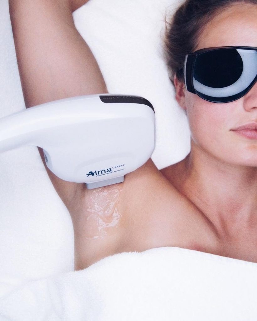 Laser Hair Removal